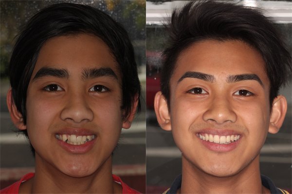 glenview dental treatment